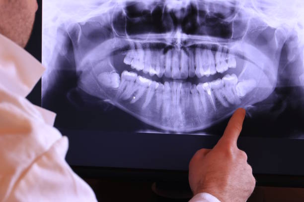 Best Emergency Dental Care for Broken or Chipped Teeth in Clinton, AR